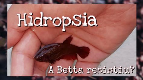 hidropsia betta